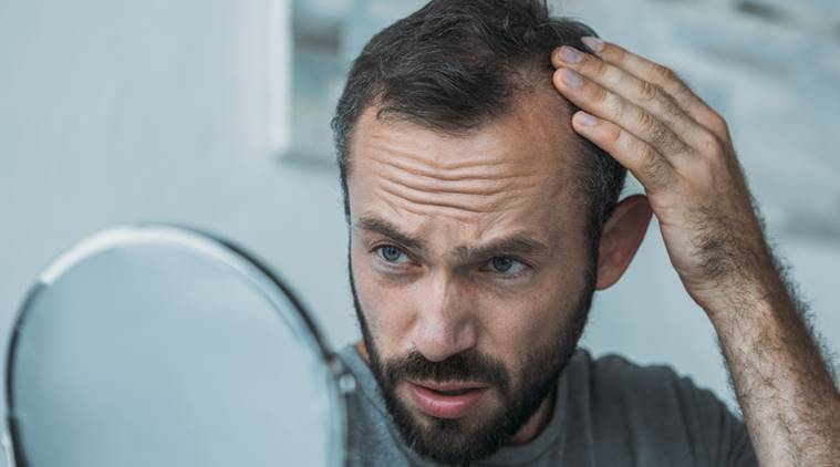 hair loss treatment for men